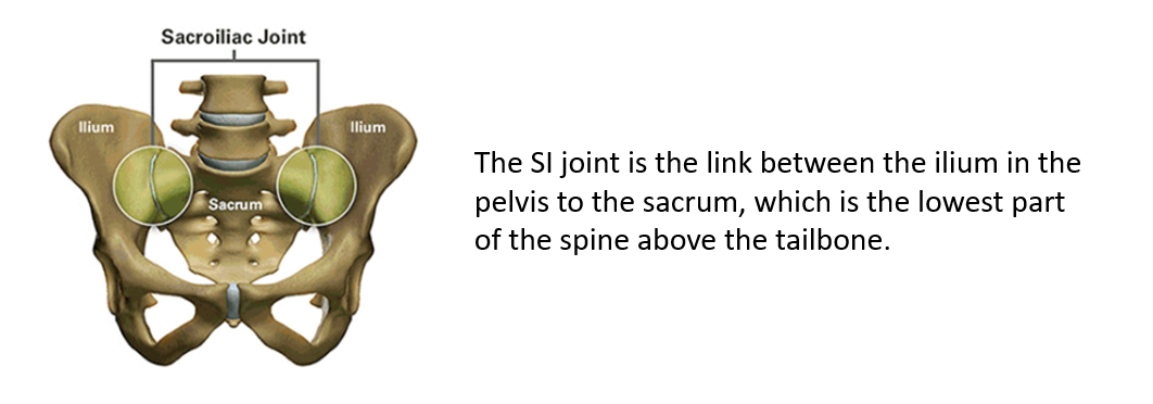 the si joint is the link between the ilium in the pelvis to the sacrum, the lowest part of the spine above the tailbone