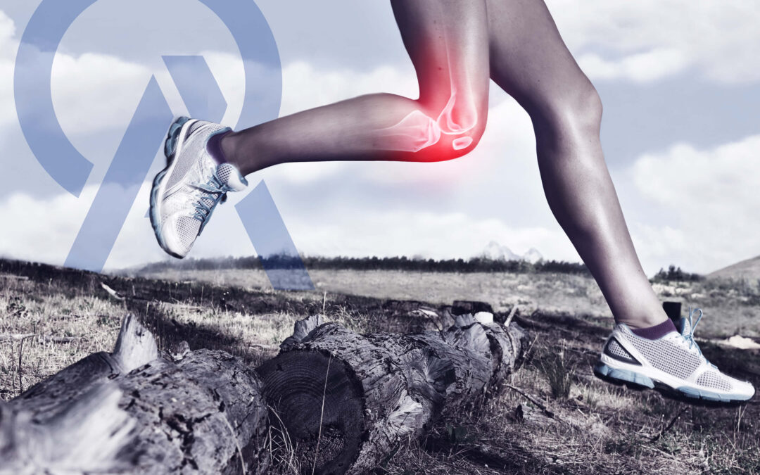 How to Ensure a Good Recovery After ACL Surgery